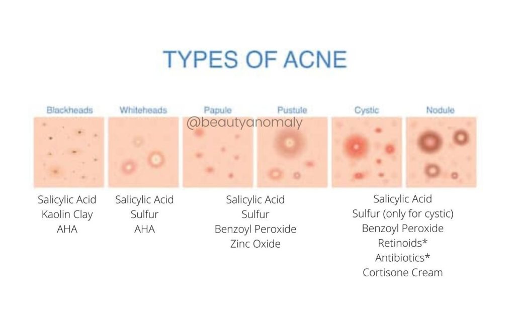 types of acne